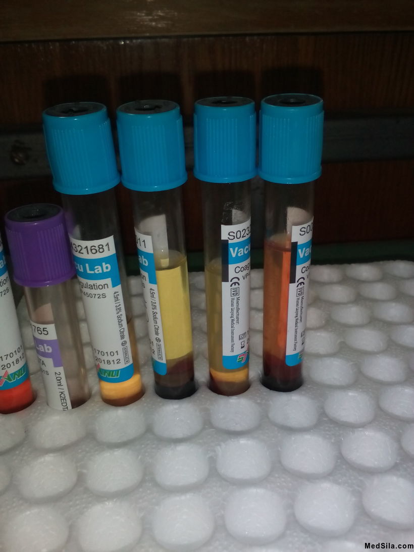 Пробирки для определения Д - димеров